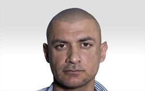 Need a Head Tattoo / Scalp Tattoo for your Balding head?