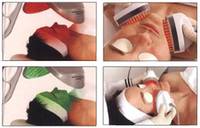 40%OFF Microdermabrasion Mississauga Brampton Milton Toronto