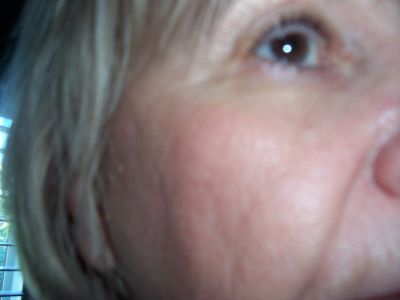 Our Product Will change Your Skin