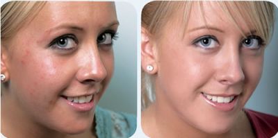 Natural beauty cream to stay fresh and young