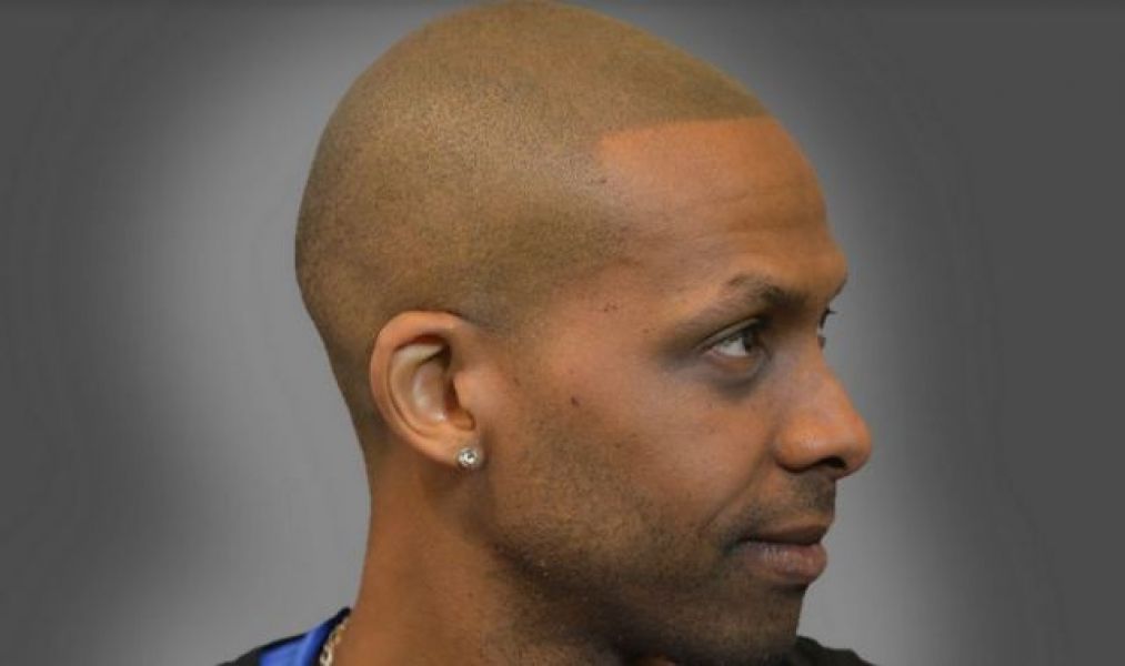 Need a Head Tattoo / Scalp Tattoo for your Balding head?