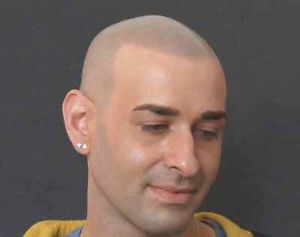 Need a Head Tattoo / Scalp Tattoo for your Balding head?